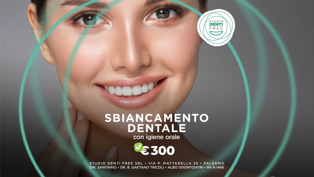 Sbiancamento dentale professionale €300. Comprensiva di igiene orale, fotografie e valutazione del colore. Fluoro Profilassi.